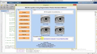 Iris Recognition Using Segmentation Feature Extraction Matlab Project with Source Code