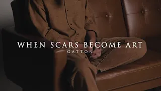 gatton when scars become art acoustic 