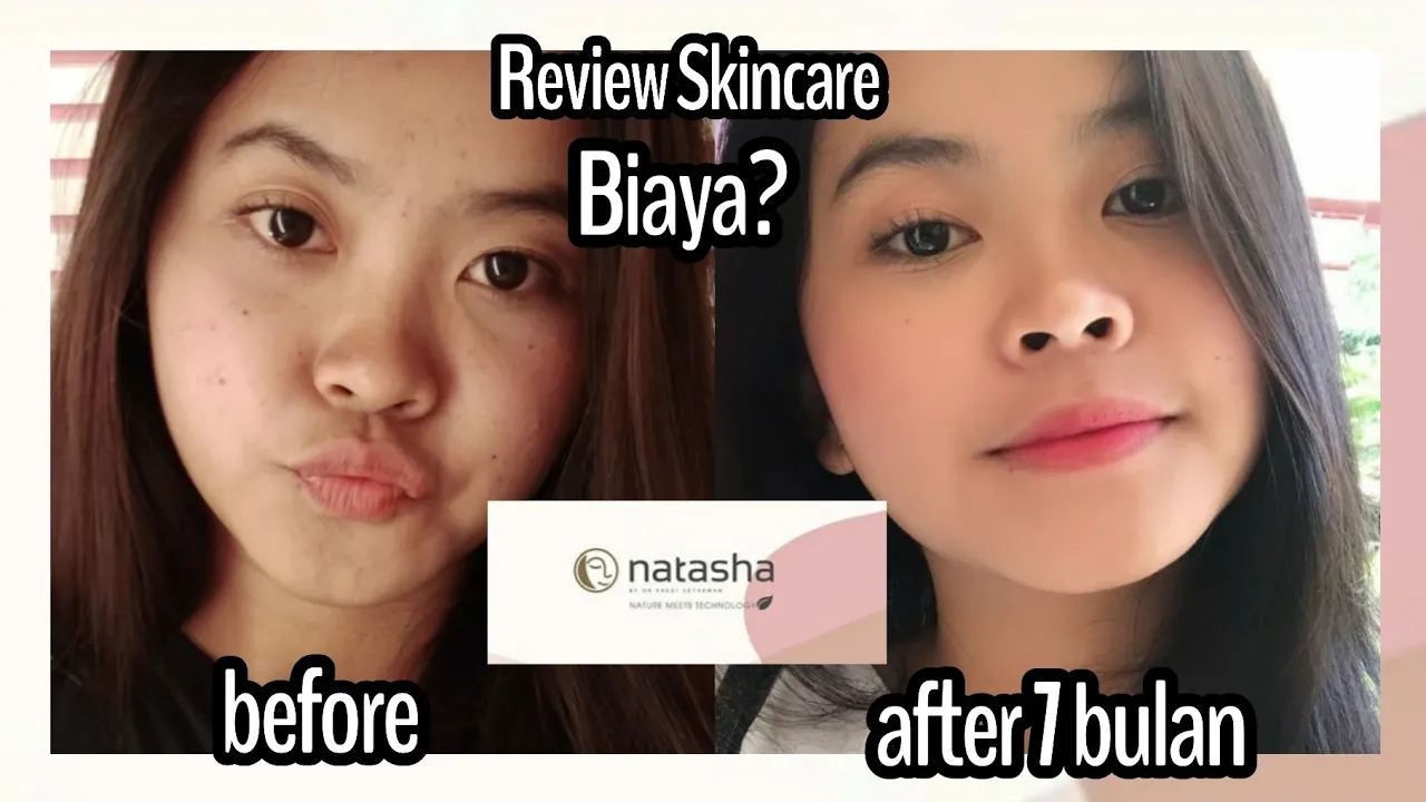AKHIRNYA PILIH NATASHA SKINCARE | BAHAS HARGA DAN PELAYANAN | erselita. 