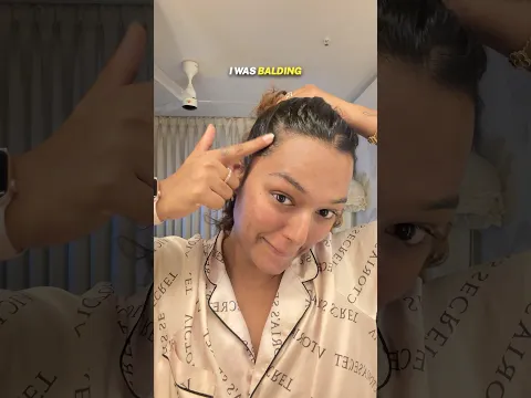 *REAL HAIR GROWTH RESULTS* but can’t CHAMPI anymore!! #shorts #ashortaday