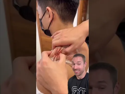 Side Effects of Releasing a PAINFUL Shoulder Knot!