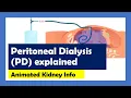 Peritoneal Dialysis explained