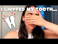 WEEKLY VLOG Chipping My Tooth and Wedding Anniversary Weekend