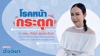 การวินิจฉัยโรคหน้ากระตุกต้องทำอย่างไรบ้าง