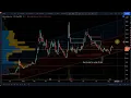 Microvision Breakout Looming IS