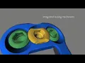 Medtronic: Atlantis Translational