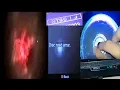 PS2 All Errors Bonus error