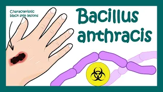 Download Anthrax: Bacillus anthracis | What does Bacillus anthracis do to humans | what is Anthrax MP3