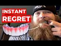 What No One Told Me About Dental Implants After 1 Year