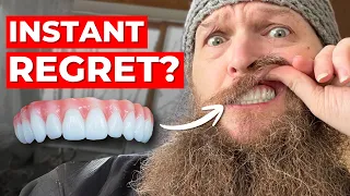 What No One Told Me About Dental Implants After 1 Year