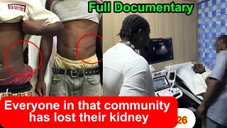 How VDM Uncovered Kidney Harvesting That Affected An Entire Community