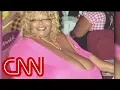 Woman s breasts weigh 89 pounds