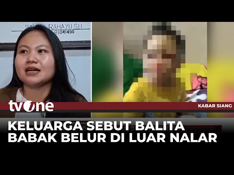 Saksi Kunci Ungkap Terkait Misteri Balita di Garut Alami Babak Belur