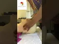 How to open the airway using the JAW thrust maneuver