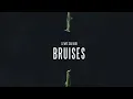 Lewis Capaldi - Bruises (Official Audio)