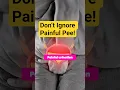 Lagu Is It Painful to Pee? Warning Signs You Shouldn't Ignore! #ytshorts #painful #urination #urologist