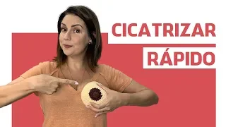 Fissuras mamilares como cicatrizar rápido - ANDRESSA BORTOLASSO