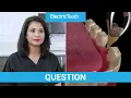 How to heal faster after a tooth extraction