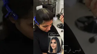 آموزش فیس فریم دندنها