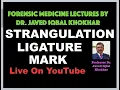 51 LIGATURE MARK IN STRANGULATION-BY DR JAVED IQBAL KHOKHAR