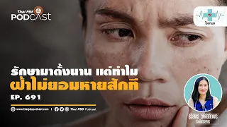 การใช้ครีมกันแดดช่วยป้องกันฝ้าได้จริงหรือไม่