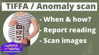 Download 5 month pregnancy anomaly scan / TIFFA scan MP3