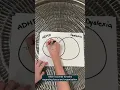 AD Dyslexia