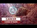 Download Lagu How does a person die from cancer? | 3D Animation