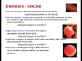 Osmolarity and Effects of isotonic hypertonic and hypotonic solutions on red blood cells