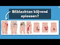 Download Lagu Bilklachten BLIJVEND oplossen? Bekijk jou oorzaak!