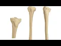 Quiz Femur Tibia Fibula