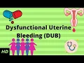 Dysfunctional Uterine Bleeding DUB Causes Signs and Symptoms Diagnosis and Treatment