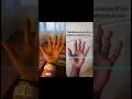 Download Lagu Real doctor tries viral TikTok surgeon challenge
