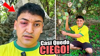 CASI PIERDO UN OJO - TUVE UN ACCIDENTE