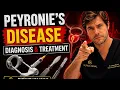 Can Peyronie s Disease Be Treated Best Options Explained