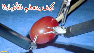 شاهد كيف يتعلم الاطباء الجراحين Watch How Surgeons Learn 