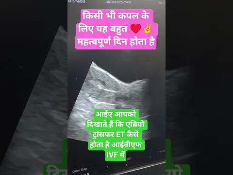 इस दिन का सभी को बेसब्री से इंतजार रहता है #hardoi