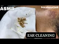 Download Lagu ASMR Ear Cleaning with Rain Sound \u0026 Ambient Background 🌧️✨ Sleep \u0026 Relaxation 