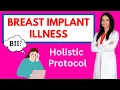 Download Lagu Breast Implant Illness (BII): A Comprehensive Guide and Holistic Approach to Healing by Dr. Rajsree