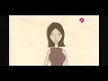 plastic surgery breast expansion animation