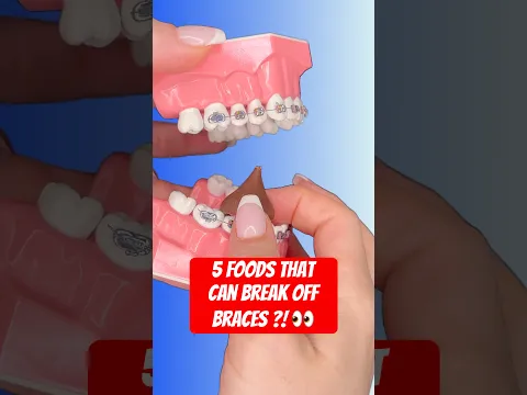 5 FOODS THAT CAN BREAK OFF BRACES *THESE MIGHT SURPRISE YOU! 👀 #braces #crunchy #foodasmr