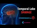 Temporal Lobe Damage Pathophysiology for Nurses