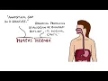 Hiatal Hernia Explained (Hiatus Hernia)
