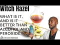 Witch Hazel What is it and is it better than alcohol and peroxide
