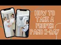 Download Lagu How to Take Proper Pano X-Rays! #shorts