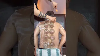  الحجامة  او كاسات الهواء الفرق بينهما شو دندنها