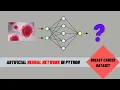 Artificial Neural Network ANN for Breast Cancer Dataset Classification in Python