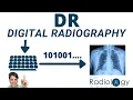 Direct vs Indirect Digital Radiography DR for Radiologic Technologists