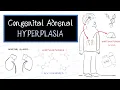 Download Lagu What is Congenital Adrenal Hyperplasia (CAH)?