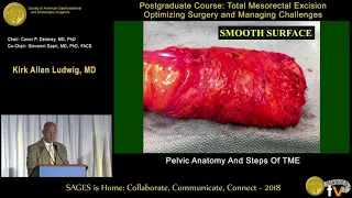 Pelvic anatomy \u0026 steps of TME